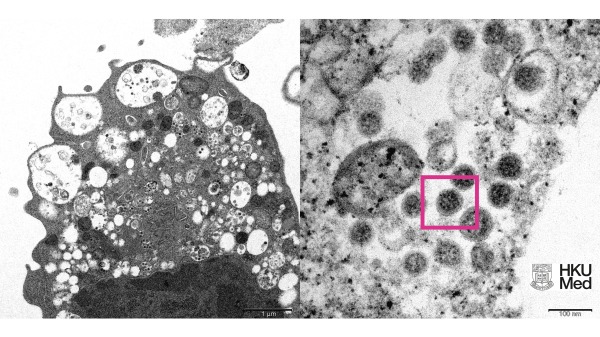 显微镜下揭示的Omicron变异株面貌。病毒颗粒表面呈现皇冠形的刺突蛋白（见红框）。（图片来源：香港大学提供）