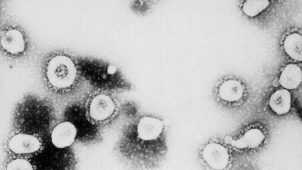 美國疾病管制與預防中心 (CDC)冠狀病毒微觀視圖2(16:9)