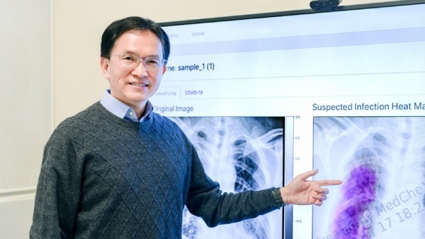 國立成功大學指，資訊工程學系特聘教授蔣榮先團隊已成功開發「MedCheX：AI輔助胸腔X光片判讀系統」，可快速預測罹患COVID-19風險，且公開於網路上提供免費使用。