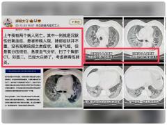 大陆疯传原始毒株重现医护曝恐怖“白肺”(视频)