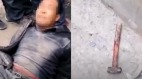 甘肃岷县发生故意伤害幼儿园幼童恶性事件(视频)