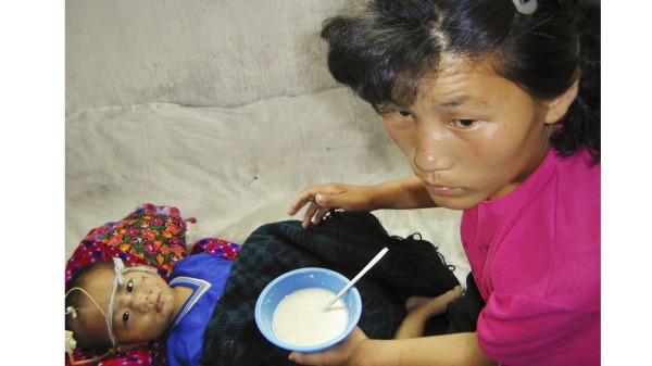 在世界粮食计划署的这份讲义中，一名营养不良的朝鲜男孩，3 岁的 Jong Song Chol，被喂食了一种由联合国世界粮食计划署提供的富含维生素和矿物质的粥。
