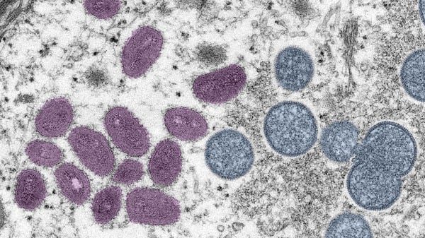 猴痘病毒电子显微镜 (EM) 数字彩色图像